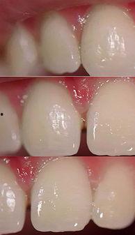 欧美牙齿素材视频下载软件,一键获取专业资源